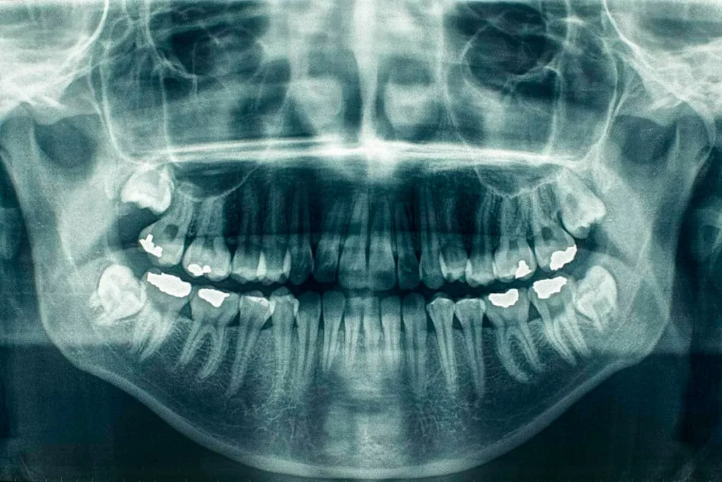 Finding Problems Below the Surface With X-Rays